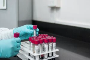Descoperirea care schimbă tot ce se știa despre bolile hepatice. Speranță pentru pacienții din întreaga lume