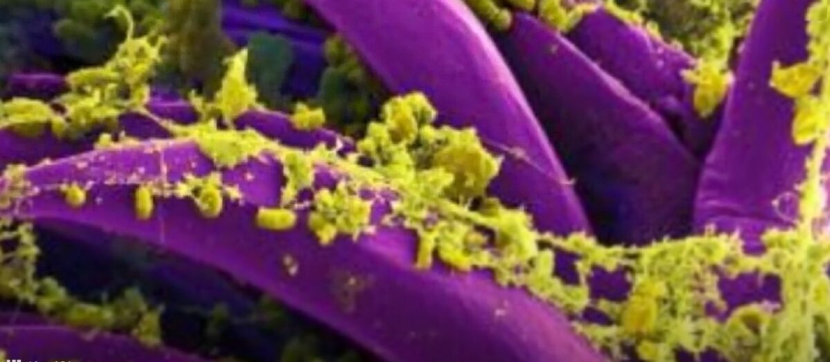 Ciumă în California. Rezident testat pozitiv