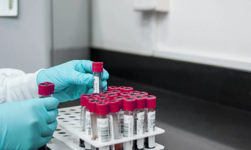 Rogobete: Analizele de sânge ar putea fi recoltate în cabinetele medicilor de familie