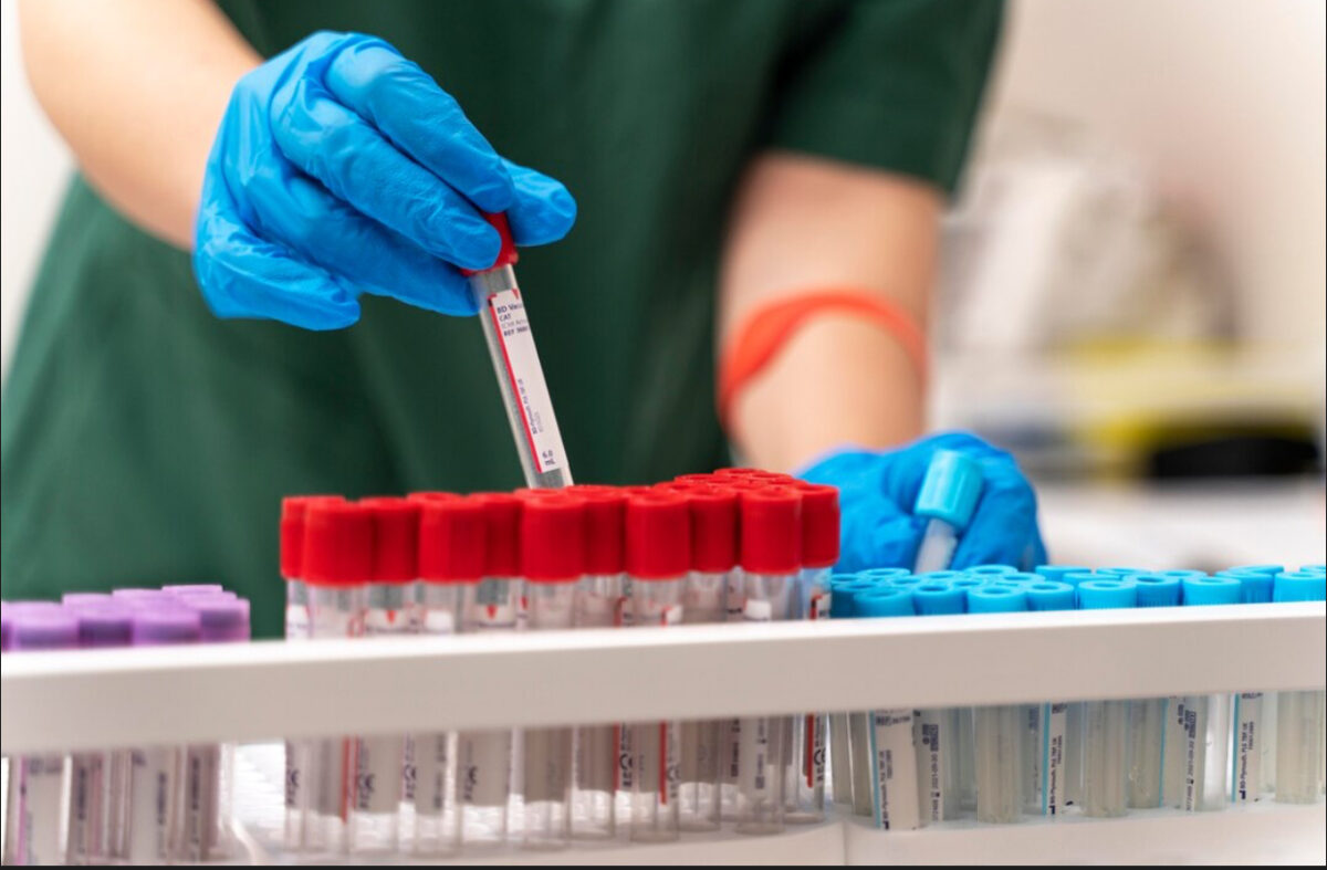 Alertă medicală în Dolj. 150 de cazuri de hepatită A, confirmate  de DSP