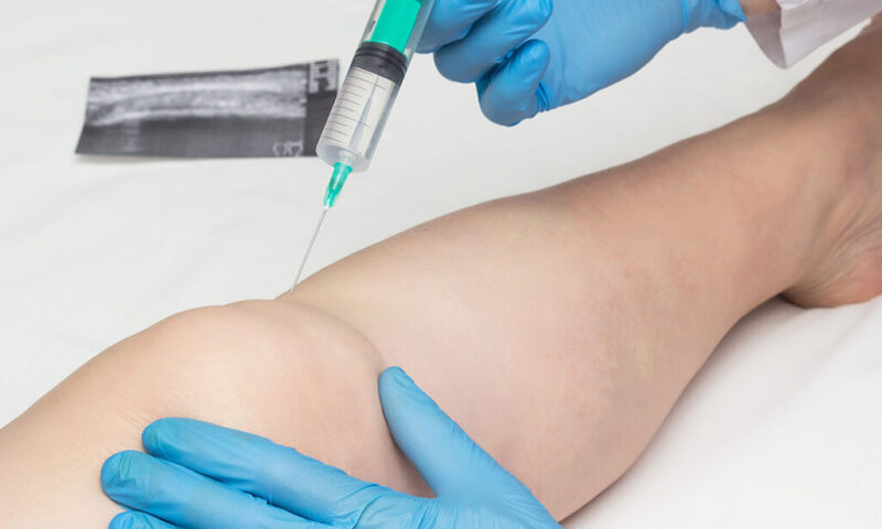 Trei motive pentru care ozonoterapia te ajută să-ți consolidezi starea de sănătate înainte de sezonul rece