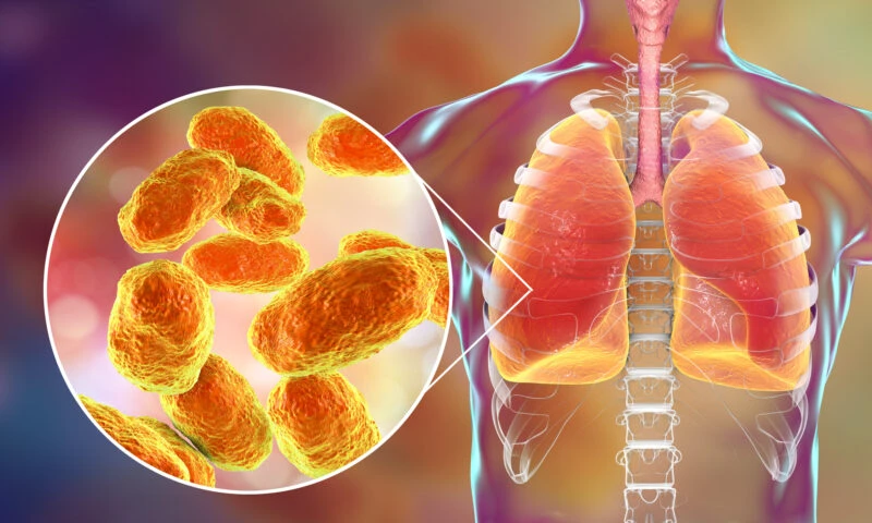 Bacteriile care provoacă infecțiile pulmonare pot evolua și reveni după tratament