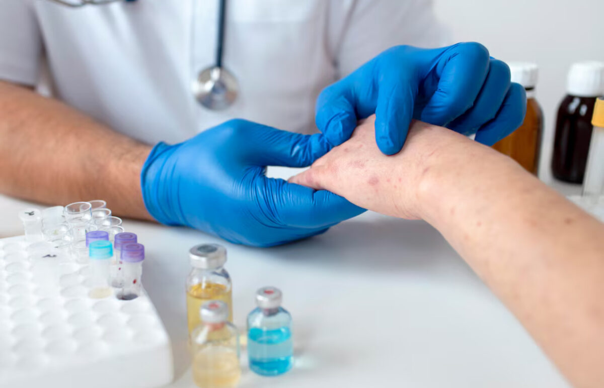 Încă un caz de lepră confirmat în Cluj. Alți trei pacienți, supuși verificărilor medicale