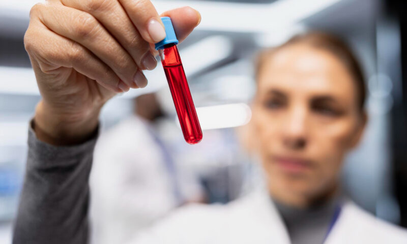 Soluția revoluționară care oprește hemoragiile în câteva secunde. Varianta descoperită pentru situațiile extreme