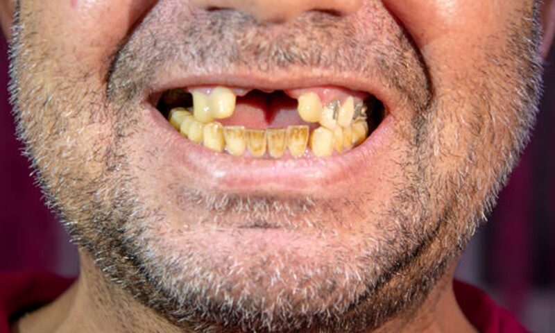 Poveștile celor mai urâți oameni din lume. Toată lumea a râs de ei