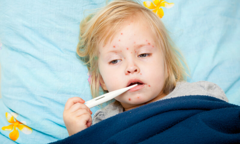 Zeci de cazuri de rujeolă, raportate în nordul Londrei. Autoritățile cer vaccinarea urgentă a copiilor